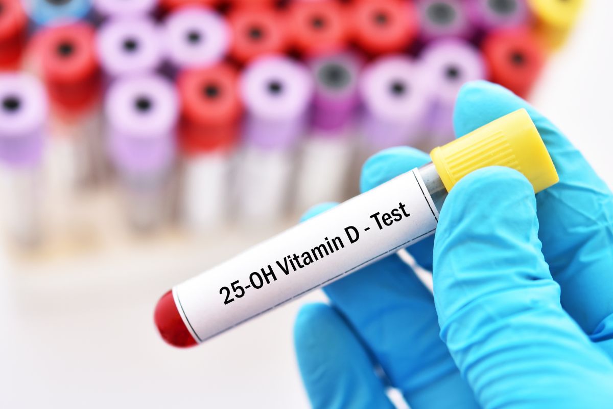 Test vitamina D in farmacia Lariana - Abbadia Lariana (LC)